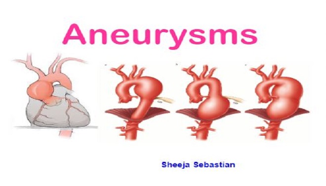 Aneurysms