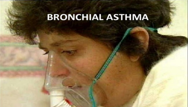 BronchialAsthma