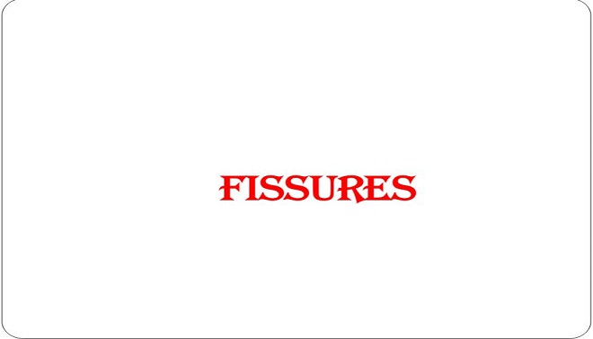 Fissures